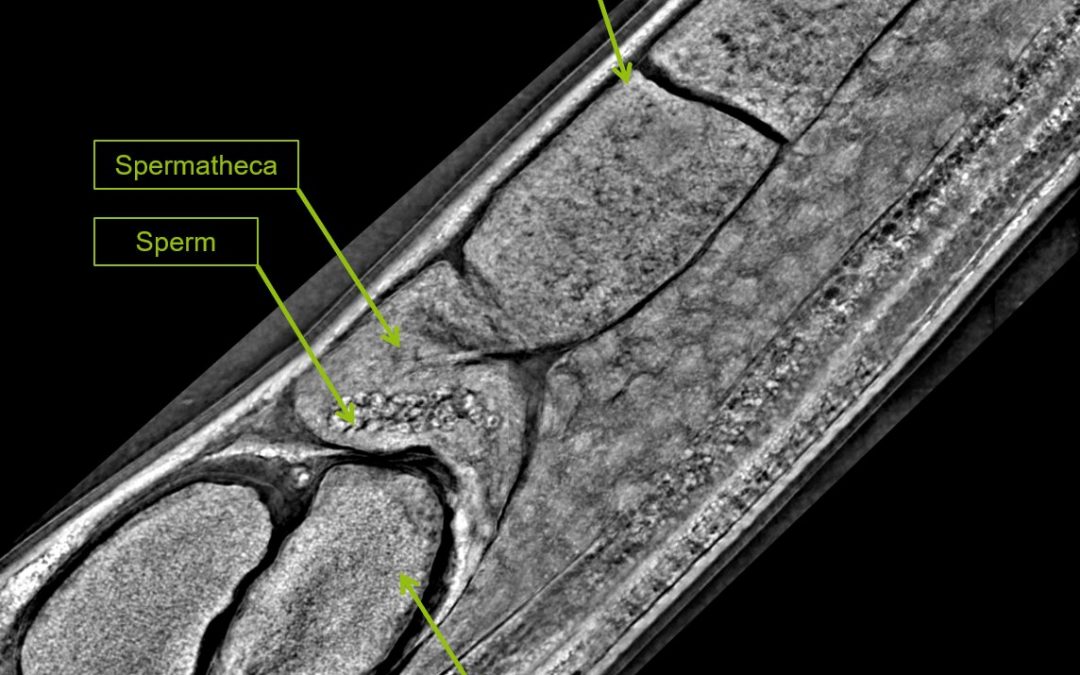 Label-free live cell imaging of C.elegans
