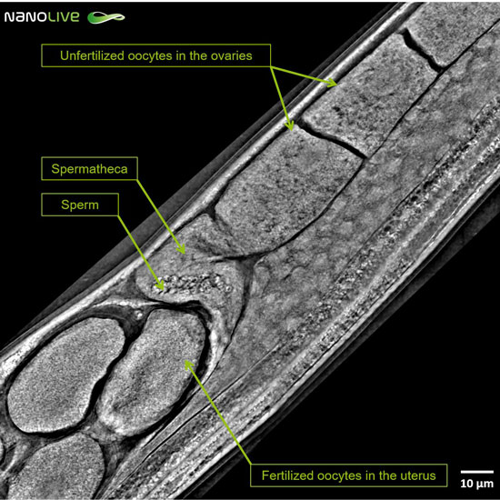 C. elegans' reproductive system - label-free live cell imaging by Nanolive