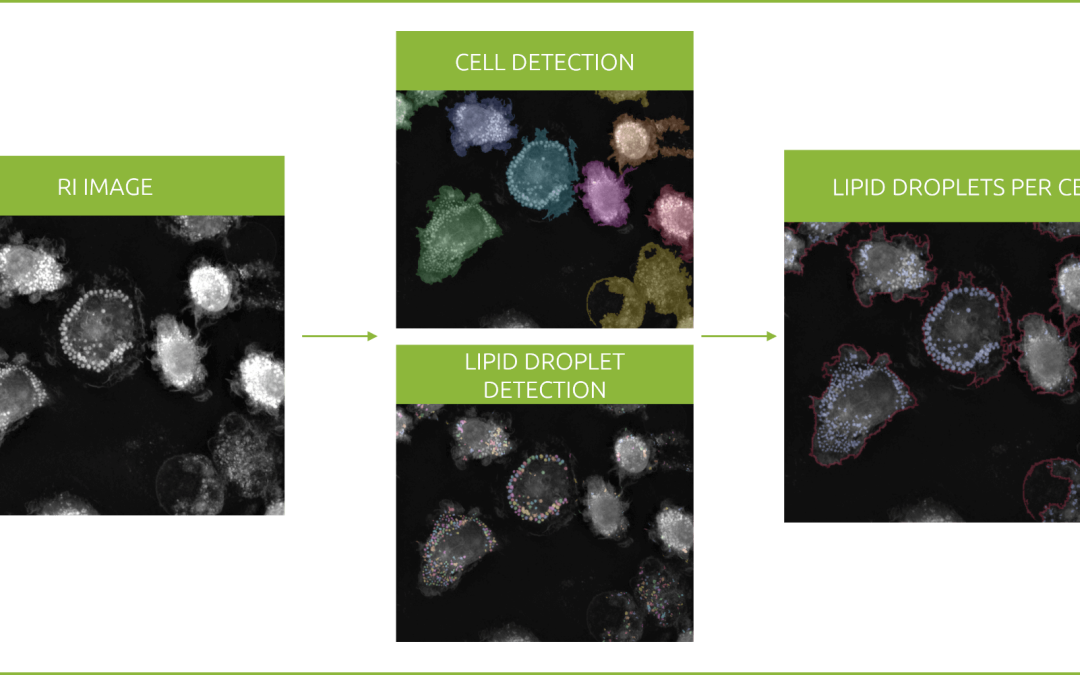 Revolutionizing lipid droplet analysis: insights from Nanolive’s Smart Lipid Droplet Assay Application Note