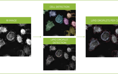 Revolutionizing lipid droplet analysis: insights from Nanolive’s Smart Lipid Droplet Assay Application Note