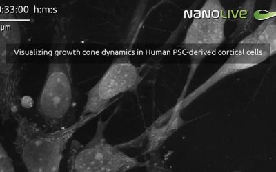 Shining a spotlight on Nanolive research in Belgium