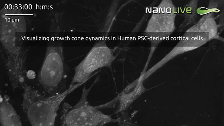 Shining a spotlight on Nanolive research in Belgium