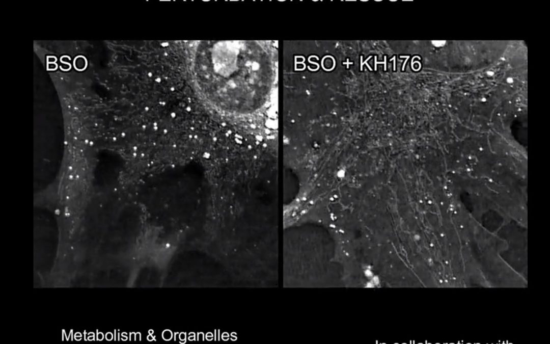 Monitoring live and label free effect of Khondrion’s drug KH176 with the 3D Cell Explorer