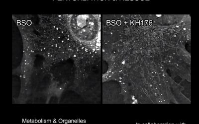 Monitoring live and label free effect of Khondrion’s drug KH176 with the 3D Cell Explorer