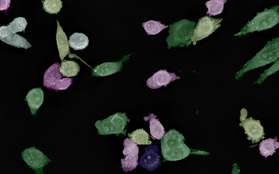 Webinar – The LIVE Cell Death Assay: Drug discovery applications of cell health, stress, death, and recovery analyses