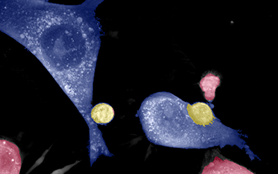 The Live T Cell Assay: what do Key Opinion Leaders say about it?