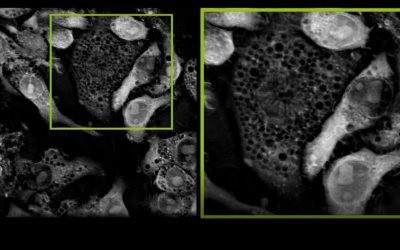 A microscopic view of label-free and living Listeria bacteria