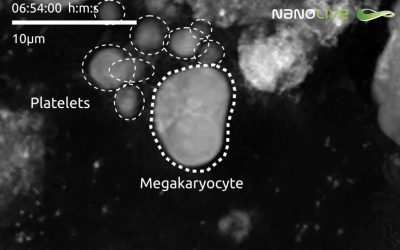 High resolution live footage of the formation and spontaneous release of platelets