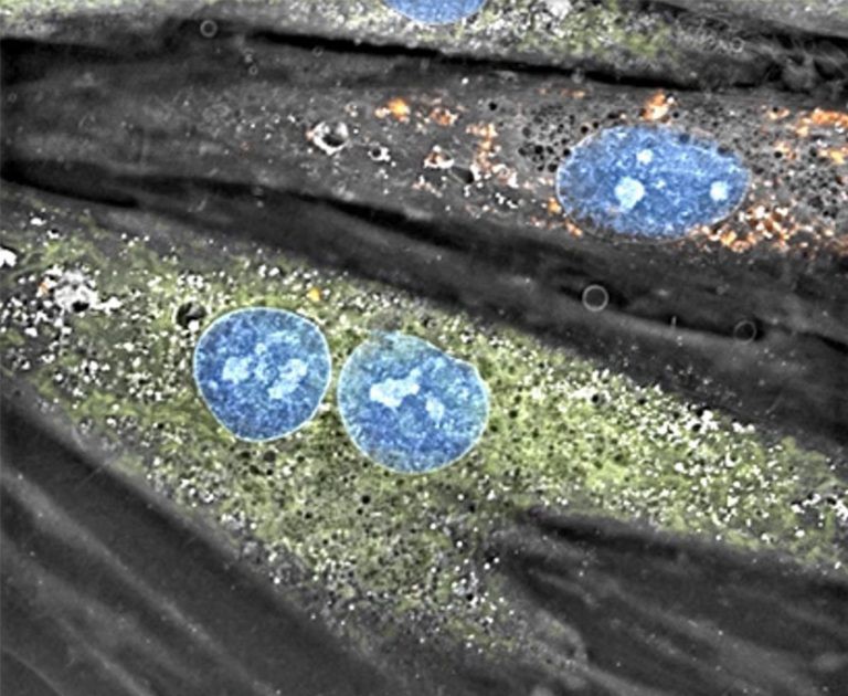 Bioenergetics Consequences of Mitochondrial Transplantation in Cardiomyocytes