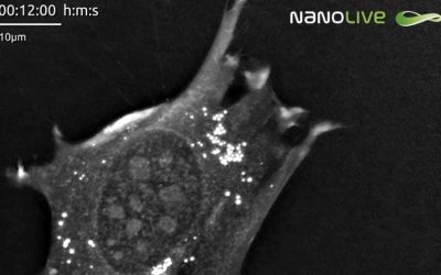 Article: norepinephrine triggers lipid accumulation