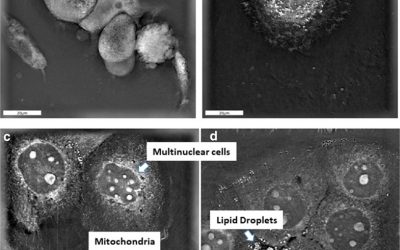 New publication: Pleiotropic Effects of Epithelial Mesenchymal Crosstalk on Head and Neck Cancer: EMT and beyond