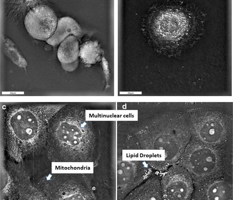 New publication: Pleiotropic Effects of Epithelial Mesenchymal Crosstalk on Head and Neck Cancer: EMT and beyond