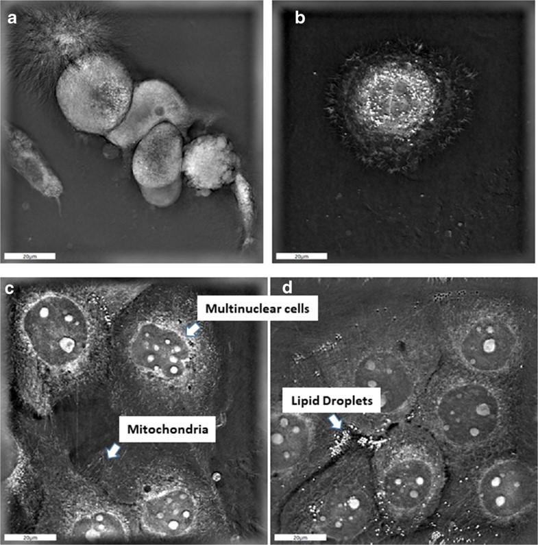 New publication Pleiotropic Effects of Epithelial Mesenchymal Crosstalk on Head and Neck Cancer EMT and beyond New publication Pleiotropic Effects of Epithelial Mesenchymal Crosstalk on Head and Neck Cancer EMT and beyond
