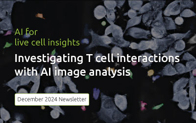 Newsletter December: Investigating T cell interactions with AI image analysis