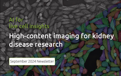 September 2024: High-content imaging for kidney disease research