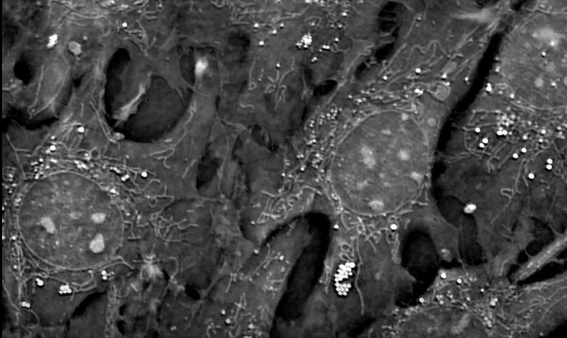 Webinar | Mitochondria and lipid droplets in the spotlight: Label free imaging of cell metabolism