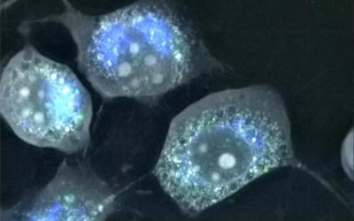 Nanolive empowers groundbreaking ferroptosis research published in Nature
