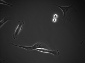 Ayanzadeh, A., Yağar, H.O., Özuysal, Ö.Y., Okvur, D.P., et al. (2019) Phase Contrast Microscopy of cells with annotation. Frame 470 (Cropped from original). Available from: https://doi.org/10.6084/m9.figshare.8965820.v2