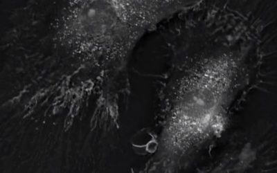 Macrophages – the big eaters