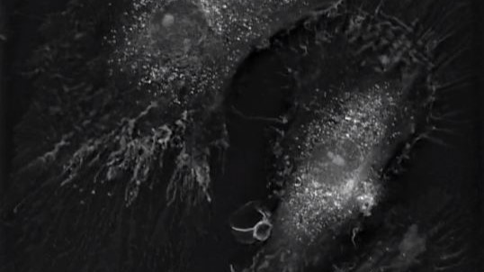 Macrophages – the big eaters