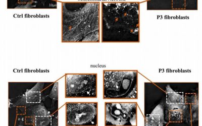 New Publication from the Laboratory of Human Lymphohematopoiesis in Paris, France