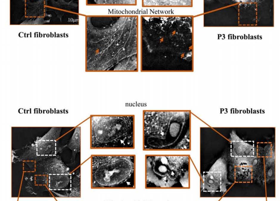New Publication from the Laboratory of Human Lymphohematopoiesis in Paris, France