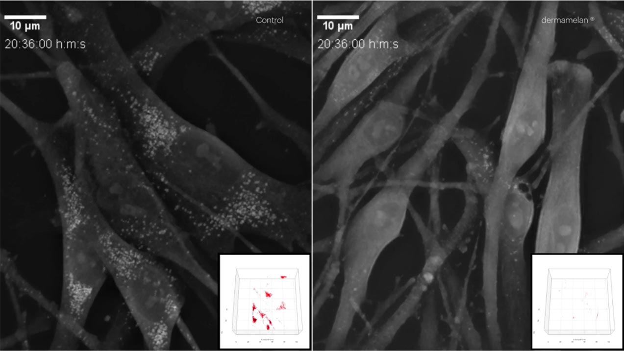 Nanolive refractive index images of treated and untreated melanocytes CX-A with 96-well plate