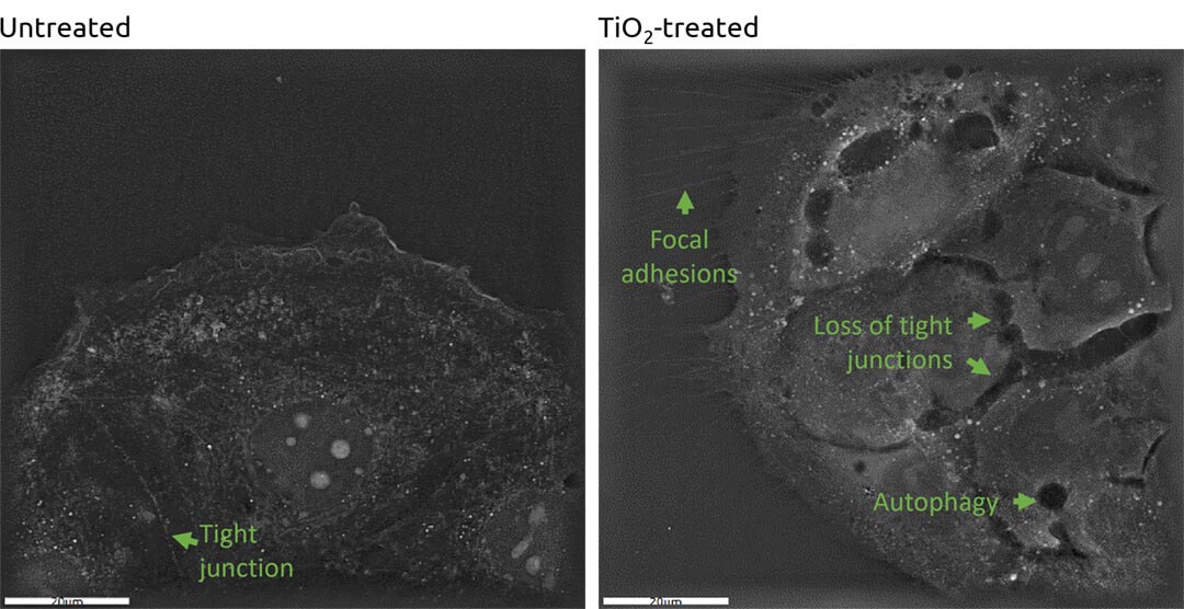 TiO2 nanoparticle effects on cellular morphology