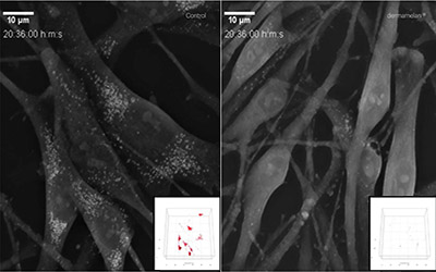 Nanolive imaging confirms success of mesoestetic’s new treatment at the subcellular level
