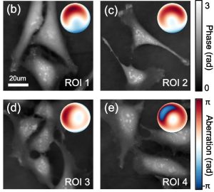 Shu, Y., Sun, J., Lyu, J. et al. Adaptive optical quantitative phase imaging based on annular illumination Fourier ptychographic microscopy. PhotoniX 3, 24 (2022). (Cropped from original). Available from: https://doi.org/10.1186/s43074-022-00071-3