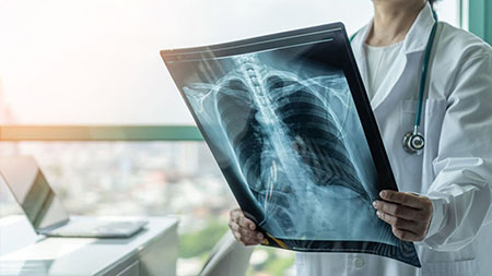 Radiotherapy Radiotherapy