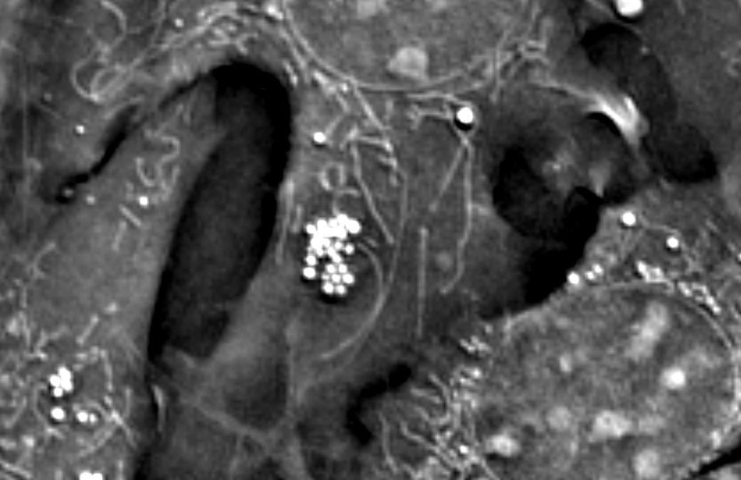 Metabolism and Organelles Unveiled with Nanolive’s 3D Label-free Live Cell Imaging Microscope
