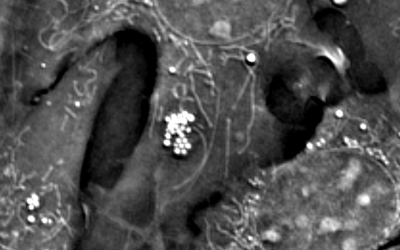 Metabolism and Organelles Unveiled with Nanolive’s 3D Label-free Live Cell Imaging Microscope