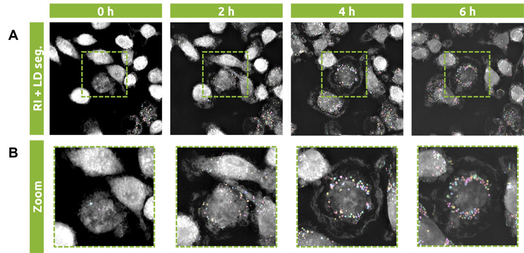 SLDA-App-Note-Fig-1 Timelapse refractive images overlaid with lipid droplet segmentations