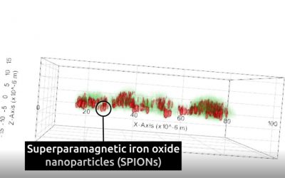 Superparamagnetic iron oxide nanoparticles (SPIONs) and Nanolive imaging: the perfect combination?