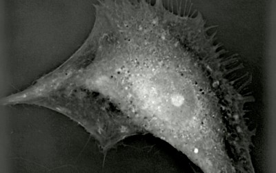 More videos from Actelion’s work
