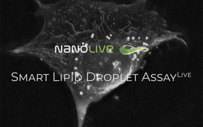 Nanolive launches the Smart Lipid Droplet Assay LIVE