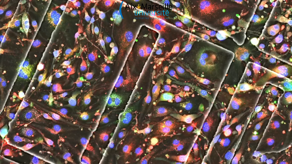 Endothelial cells from Prof. Christophe Dubois