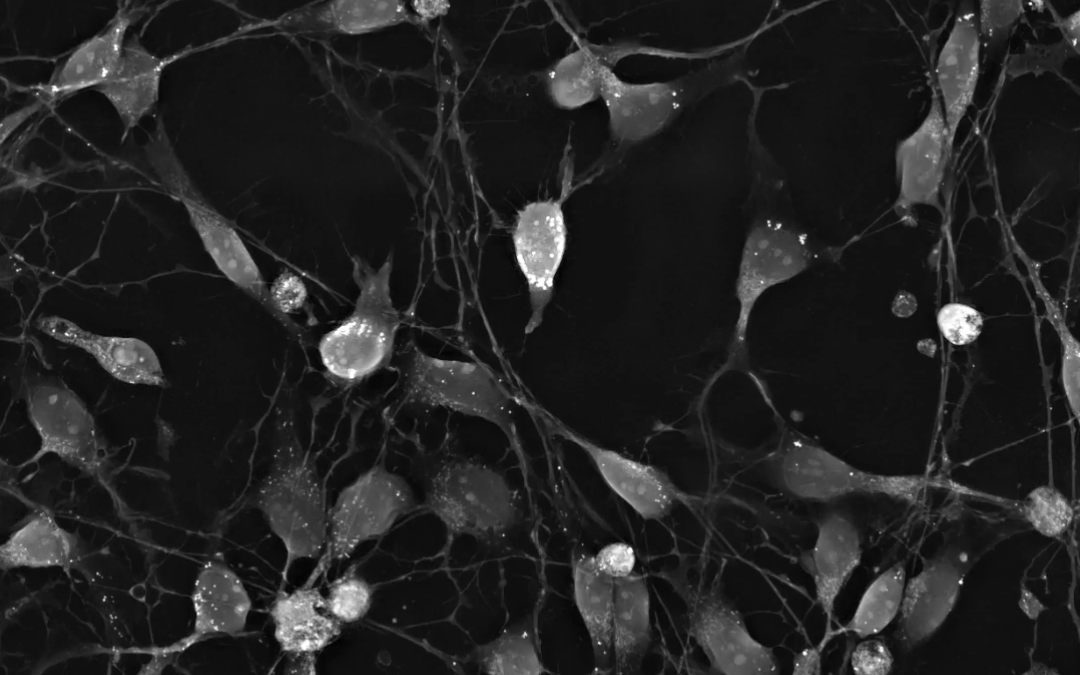 Phenotypic Screening, Cell Differentiation & Neuronal Networks: Label-free Analytics Driving Drug Discovery