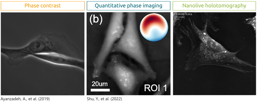 Snapshot_49 Nanolive’s holotomography: an imaging technique combining holography and tomography.