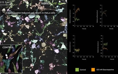 Article: Staurosporine-induced cell death