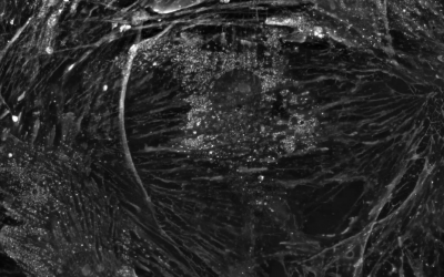 Do you want to image stress fibers – the architecture of the cell – for unlimited periods of time at high frequency?