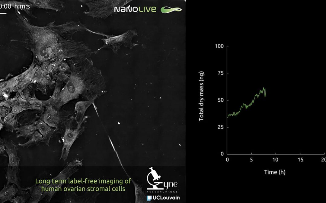 Nanolive imaging reveals the behaviour and morphology of human ovarian stromal cells in exquisite detail