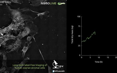 Nanolive imaging reveals the behaviour and morphology of human ovarian stromal cells in exquisite detail
