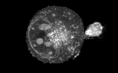 A chronicle through the eras and discoveries of cancer research. How is Nanolive contributing with their innovations?