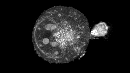 A chronicle through the eras and discoveries of cancer research. How is Nanolive contributing with their innovations?