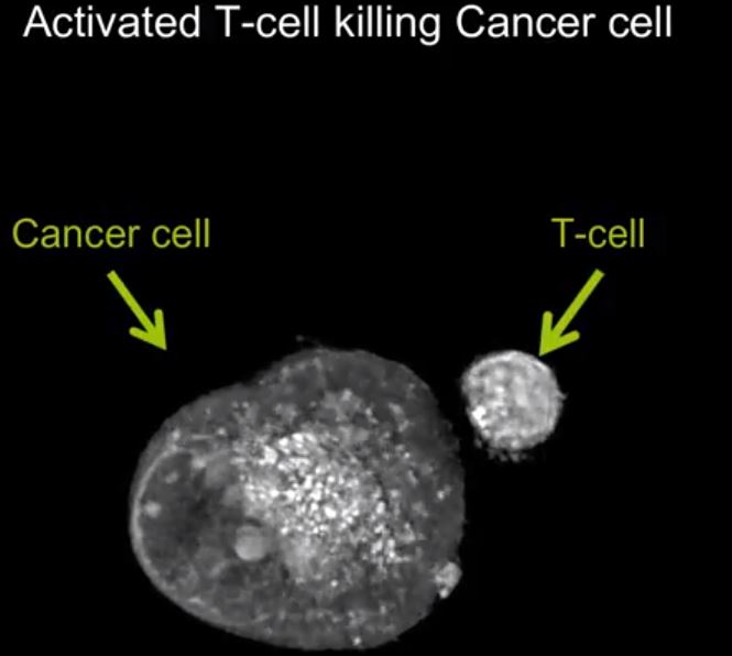 Nobel Prize goes to James P. Allison and Tasuku Honjo  for their discovery of cancer therapy by inhibition of negative immune regulation