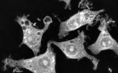 Image of the Day from The Scientist: Macrophages in Action