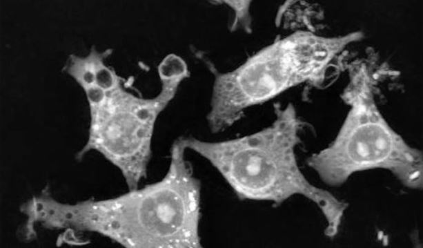 Image of the Day from The Scientist: Macrophages in Action