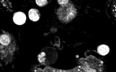 The perfect murder – Macrophage cell killed by T-cells